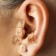 Auriculoterapia é a utilização de pontos nas orelhas para tratamento de diversos sinais e sintomas comuns em diferentes patologias e atua no âmbito físico, mental e emocional do paciente.
